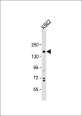 Anti-PHLPP1 antibody, N-term used in Western Blot (WB). GTX81275
