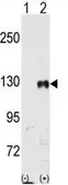 Anti-EphB1 antibody used in Western Blot (WB). GTX81349