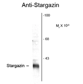 Anti-Stargazin antibody used in Western Blot (WB). GTX82595