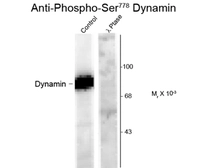 Anti-Dynamin 1 (phospho Ser778) antibody used in Western Blot (WB). GTX82702