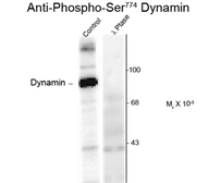 Anti-Dynamin 1 (phospho Ser774) antibody used in Western Blot (WB). GTX82703