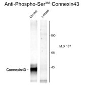 Anti-Connexin 43 (phospho Ser368) antibody used in Western Blot (WB). GTX82717