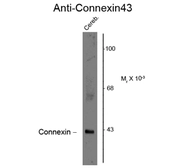 Anti-Connexin 43 antibody used in Western Blot (WB). GTX82718