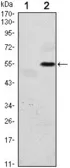 Anti-PERK antibody [5G5] used in Western Blot (WB). GTX82759