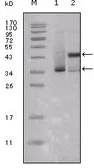 Anti-Estrogen Receptor alpha antibody [10H12B10] used in Western Blot (WB). GTX83032