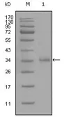 Anti-CD45 antibody [4A8A4C7A2] used in Western Blot (WB). GTX83098