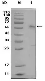 Anti-Estrogen Receptor alpha antibody [2G112B3] used in Western Blot (WB). GTX83112