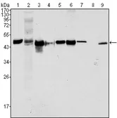 Anti-Cytokeratin 18 antibody [4D11E4] used in Western Blot (WB). GTX83142