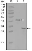 Anti-Estrogen Receptor alpha antibody [8H9A10] used in Western Blot (WB). GTX83161