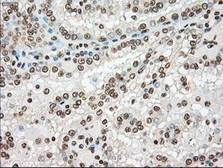 Anti-TYRO3 antibody [2C4] used in IHC (Paraffin sections) (IHC-P). GTX83458