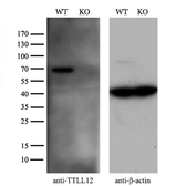 Anti-TTLL12 antibody [12B7] used in Western Blot (WB). GTX83471