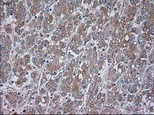 Anti-TRPM4 antibody [14C3] used in IHC (Paraffin sections) (IHC-P). GTX83491