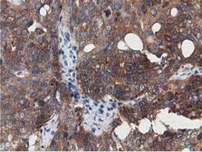 Anti-SSSCA1 antibody [2F5] used in IHC (Paraffin sections) (IHC-P). GTX83556
