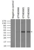Anti-alpha 1 Antitrypsin antibody [15H10] used in Immunoprecipitation (IP). GTX83665