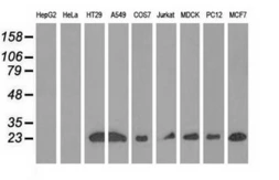 Anti-RIT2 antibody [3F4] used in Western Blot (WB). GTX83710