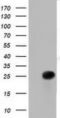 Anti-RIT2 antibody [4B5] used in Western Blot (WB). GTX83711