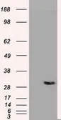Anti-Neurotrophin 3 antibody [3D4] used in Western Blot (WB). GTX83984