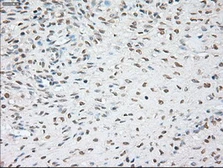 Anti-Noggin antibody [4C12] used in IHC (Paraffin sections) (IHC-P). GTX84023