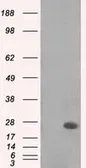 Anti-MAD2L1 antibody [4D2] used in Western Blot (WB). GTX84169