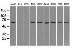 Anti-LTA4H antibody [1E9] used in Western Blot (WB). GTX84170