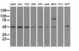 Anti-LEMD3 antibody [3H2] used in Western Blot (WB). GTX84222