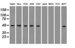 Anti-Cytokeratin 18 antibody [1H10] used in Western Blot (WB). GTX84254