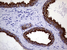 Anti-Cytokeratin 18 antibody [1E1] used in IHC (Paraffin sections) (IHC-P). GTX84256