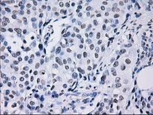 Anti-ID3 antibody [15F4] used in IHC (Paraffin sections) (IHC-P). GTX84320