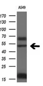 Anti-FOXA2 antibody [3C10] used in Western Blot (WB). GTX84485