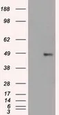 Anti-FOXA1 antibody [3A8] used in Western Blot (WB). GTX84487