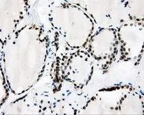 Anti-CaMKI delta antibody [2C6] used in IHC (Paraffin sections) (IHC-P). GTX84738