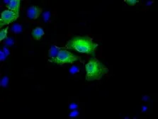 Anti-BDH2 antibody [4G4] used in Immunocytochemistry/ Immunofluorescence (ICC/IF). GTX84833