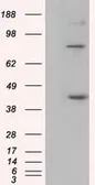 Anti-BAT1 antibody [2C5] used in Western Blot (WB). GTX84837