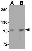 Anti-FREM2 antibody used in Western Blot (WB). GTX85004