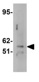 Anti-FTO antibody used in Western Blot (WB). GTX85019