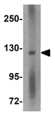 Anti-RIM2 antibody used in Western Blot (WB). GTX85035