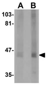 Anti-CKIP1 antibody used in Western Blot (WB). GTX85240