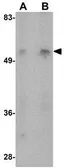 Anti-MATN1 antibody used in Western Blot (WB). GTX85287