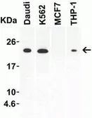 Anti-IL23 antibody used in Western Blot (WB). GTX85496