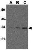 Anti-ARMER antibody used in Western Blot (WB). GTX85516