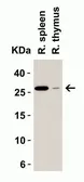Anti-MD2 antibody used in Western Blot (WB). GTX85517