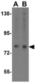 Anti-SKI antibody used in Western Blot (WB). GTX85522