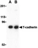 Anti-CDH13 antibody used in Western Blot (WB). GTX85891