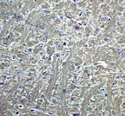 Anti-CDH13 antibody used in IHC (Paraffin sections) (IHC-P). GTX85891