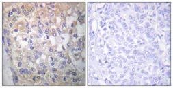 Anti-FYN (phospho Tyr530) antibody used in IHC (Paraffin sections) (IHC-P). GTX86757