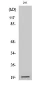 Anti-Bad (cleaved Asp71) antibody used in Western Blot (WB). GTX86887