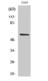 Anti-MMP15 (cleaved Tyr132) antibody used in Western Blot (WB). GTX86936