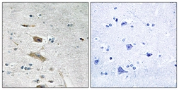 Anti-ABHD4 antibody used in IHC (Paraffin sections) (IHC-P). GTX87018