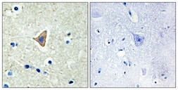 Anti-CDH20 antibody used in IHC (Paraffin sections) (IHC-P). GTX87050