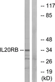 Anti-IL20RB antibody used in Western Blot (WB). GTX87090